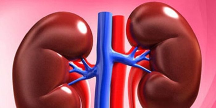 مهمترین علت ابتلا به سنگ کلیه